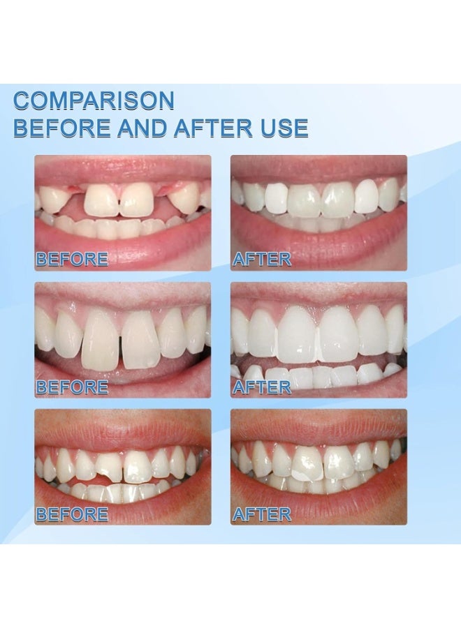 Jaysuing Moldable False Teeth White Particles Reusable Non-toxic Temporarily Fill Regain Smile Cosplay 30ml