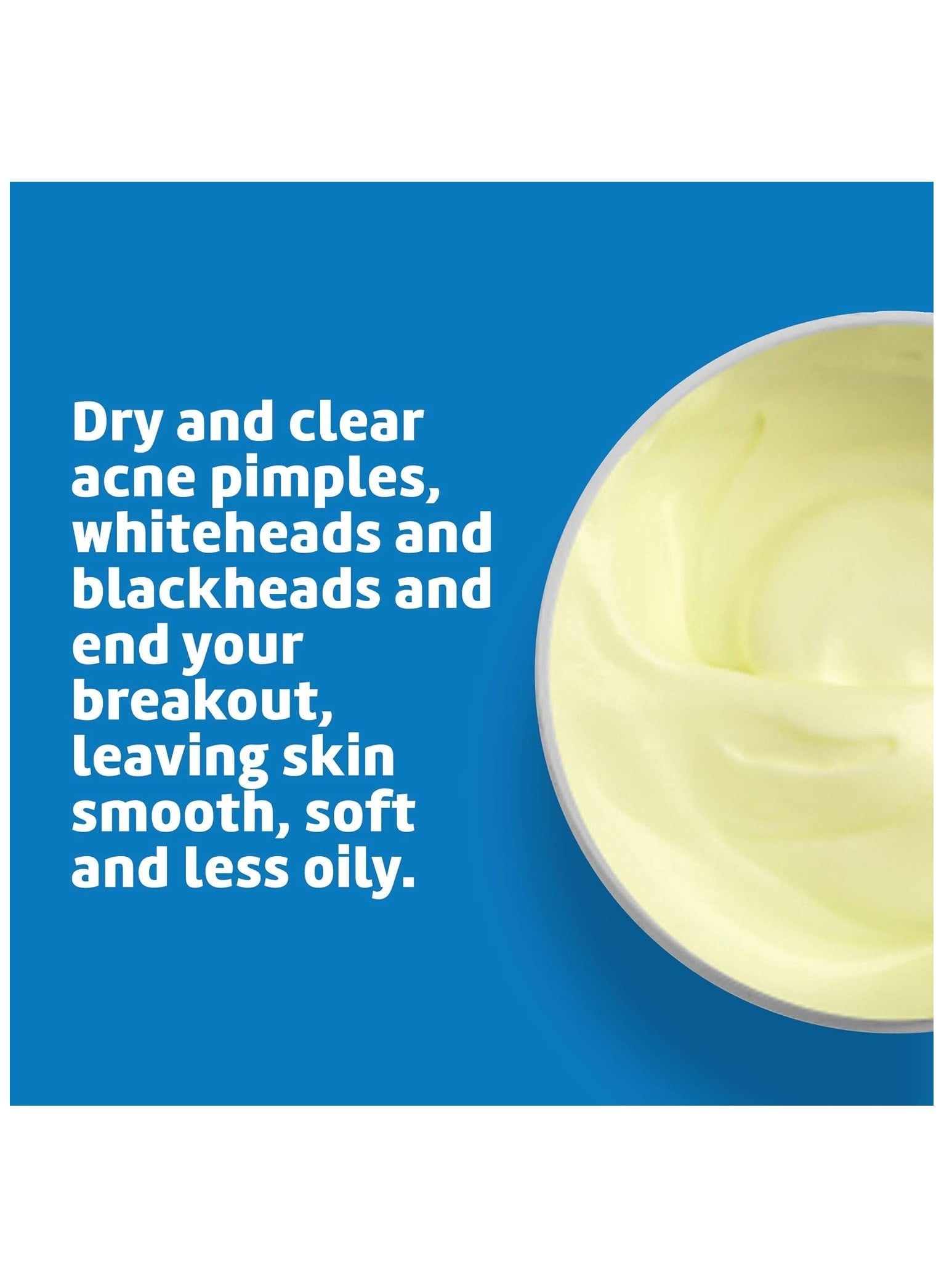 De La Cruz Acne Treatment Ointment with 10% Sulfur(73.7 g)