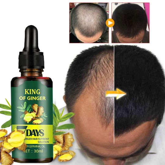 7 Days Hair Growth Natural Hair Loss Treatment