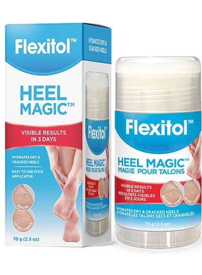 Heel Magic For Dry Skin or Rough Heels with Shea Butter  Vitamin E 2.5 Ounce